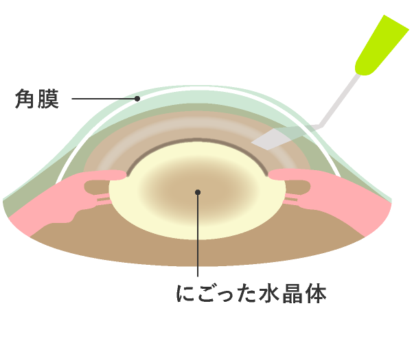 図2