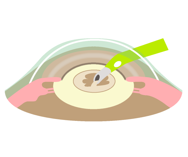図3