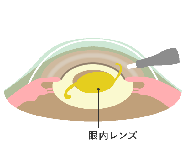 図5